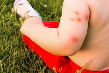 5 factos sobre mosquitos que deve saber