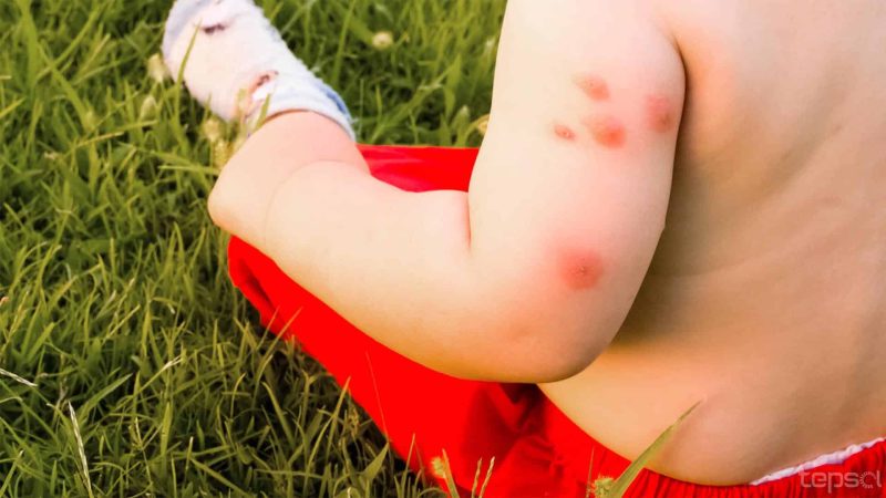 Blog - 5 Factos sobre mosquitos